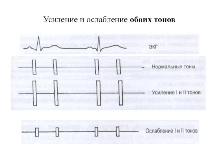 Усиление и ослабление обоих тонов