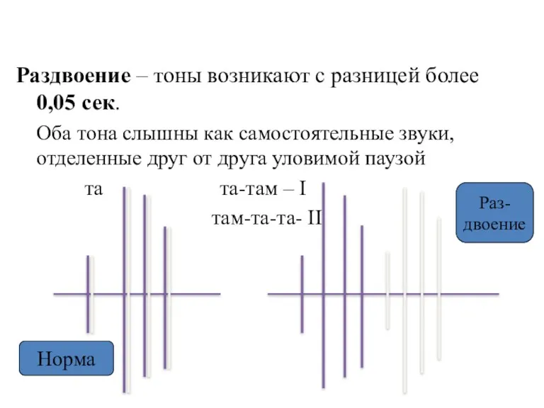 Раздвоение – тоны возникают с разницей более 0,05 сек. Оба