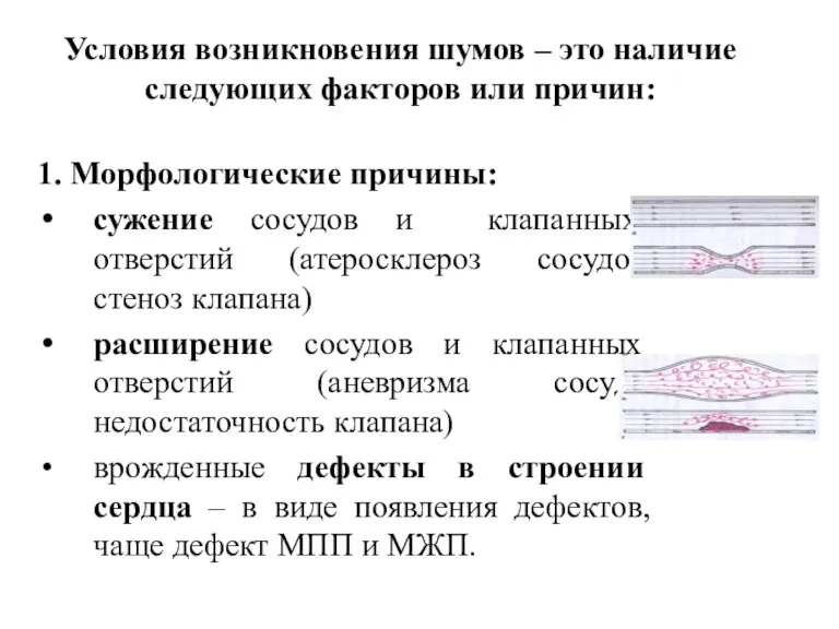 Условия возникновения шумов – это наличие следующих факторов или причин: