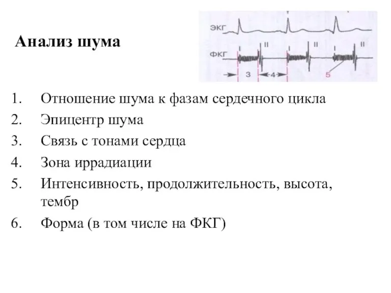 Анализ шума Отношение шума к фазам сердечного цикла Эпицентр шума