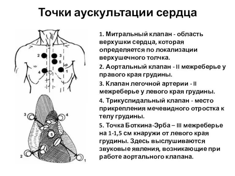 Точки аускультации сердца 1. Митральный клапан - область верхушки сердца,