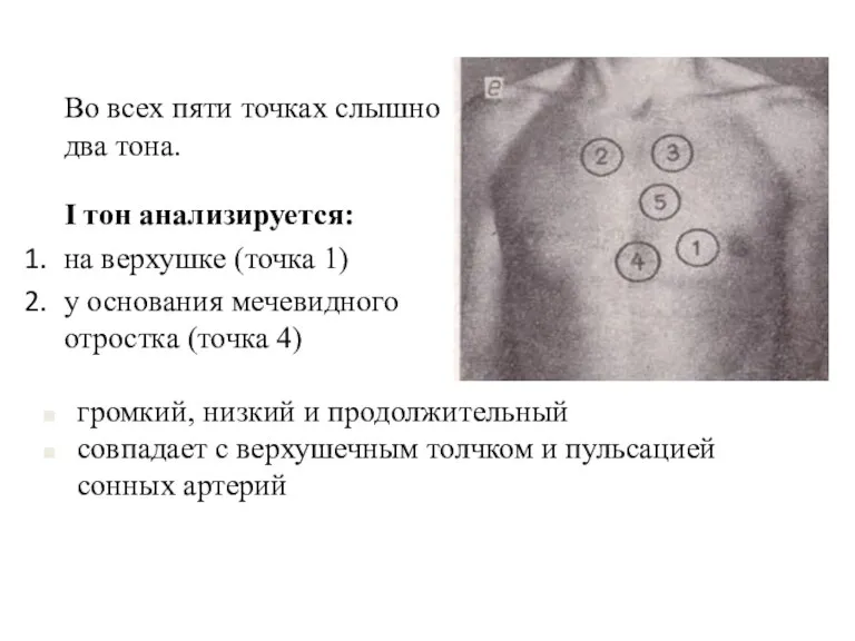 Во всех пяти точках слышно два тона. I тон анализируется: