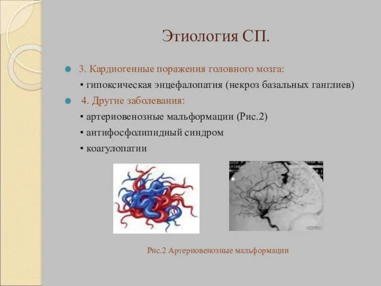 Этиология СП. 3. Кардиогенные поражения головного мозга: • гипоксическая энцефалопатия