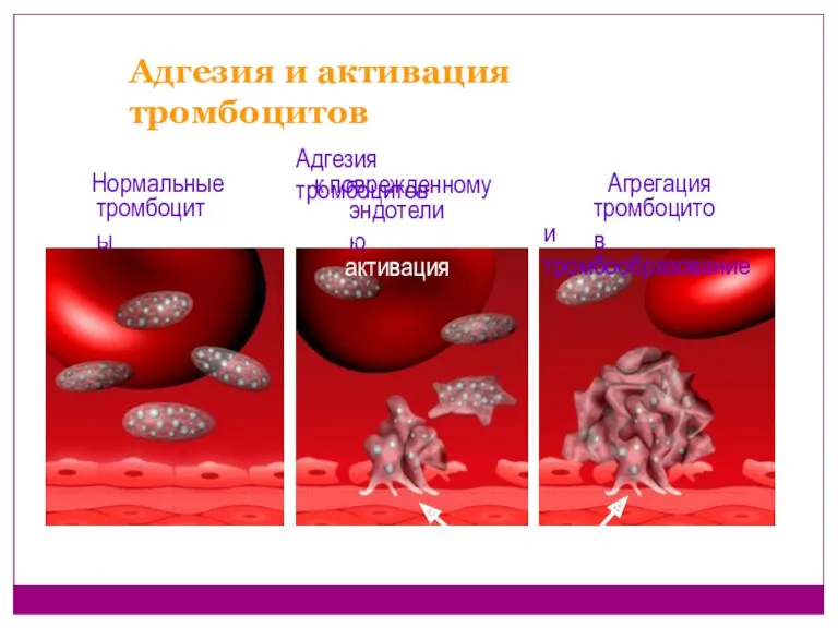 Адгезия и активация тромбоцитов Нормальные тромбоциты в кровотоке Агрегация тромбоцитов и тромбообразование Адгезия