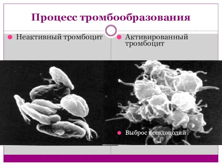 Процесс тромбообразования Неактивный тромбоцит Активированный тромбоцит Выброс псевдоподий