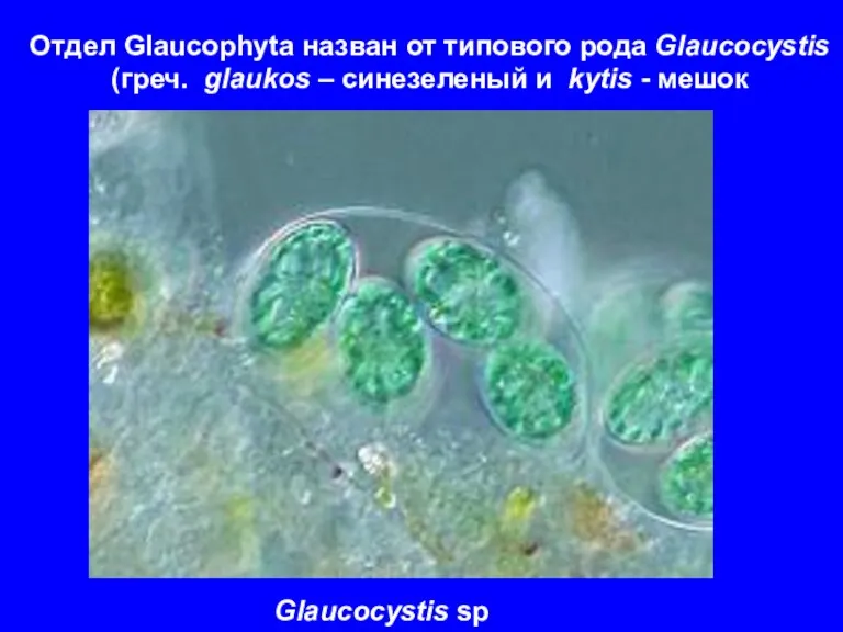 Glaucocystis sp Отдел Glauсophyta назван от типового рода Glaucocystis (греч.