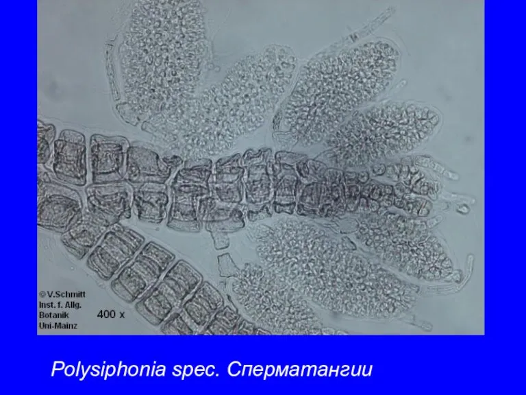 Polysiphonia spec. Сперматангии