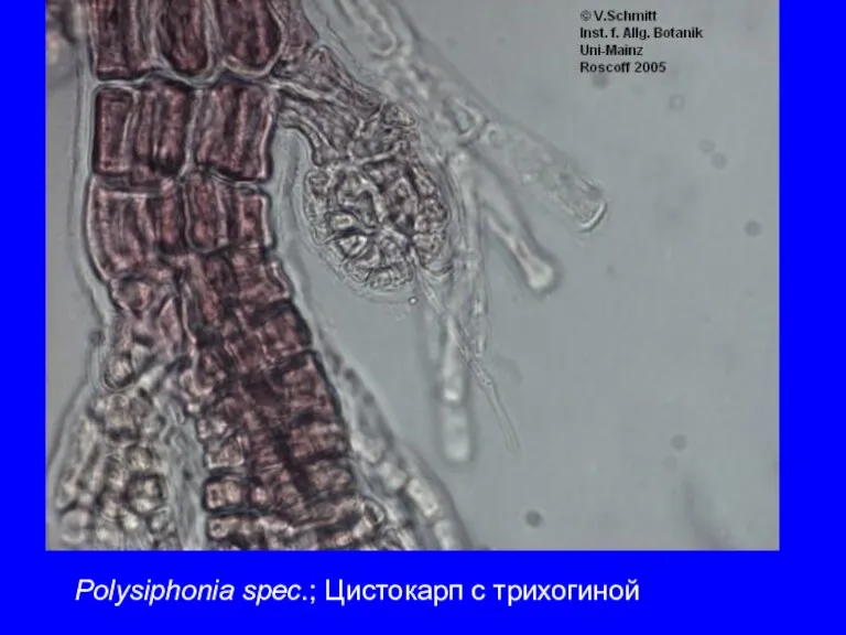 Polysiphonia spec.; Цистокарп с трихогиной