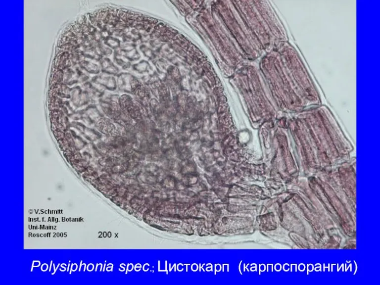 Polysiphonia spec.; Цистокарп (карпоспорангий)
