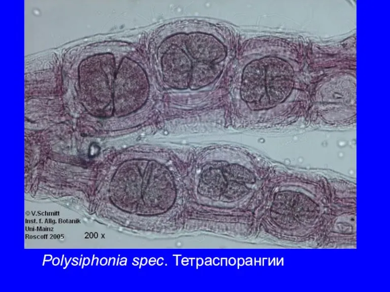 Polysiphonia spec. Тетраспорангии