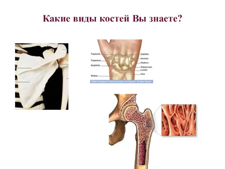 Какие виды костей Вы знаете?
