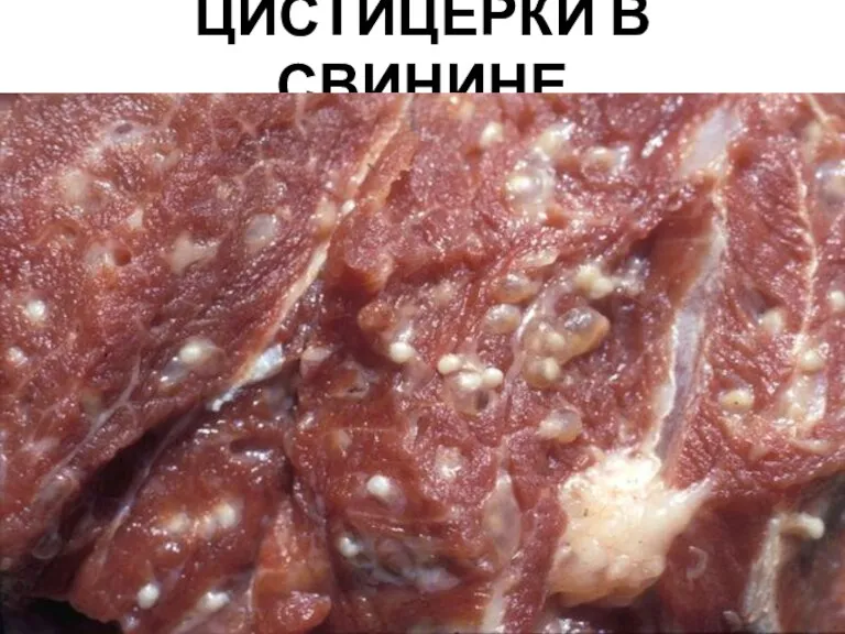 ЦИСТИЦЕРКИ В СВИНИНЕ