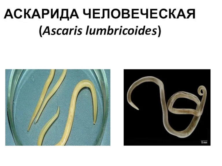 АСКАРИДА ЧЕЛОВЕЧЕСКАЯ (Ascaris lumbricoides)