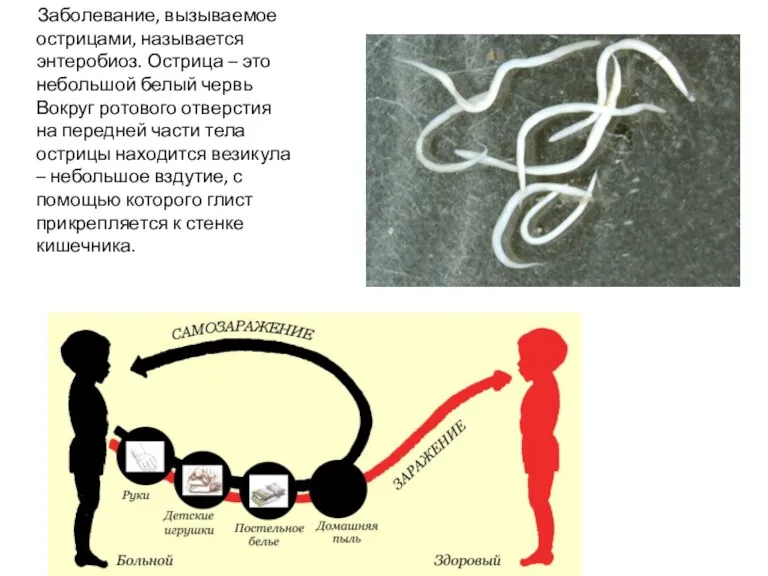Заболевание, вызываемое острицами, называется энтеробиоз. Острица – это небольшой белый