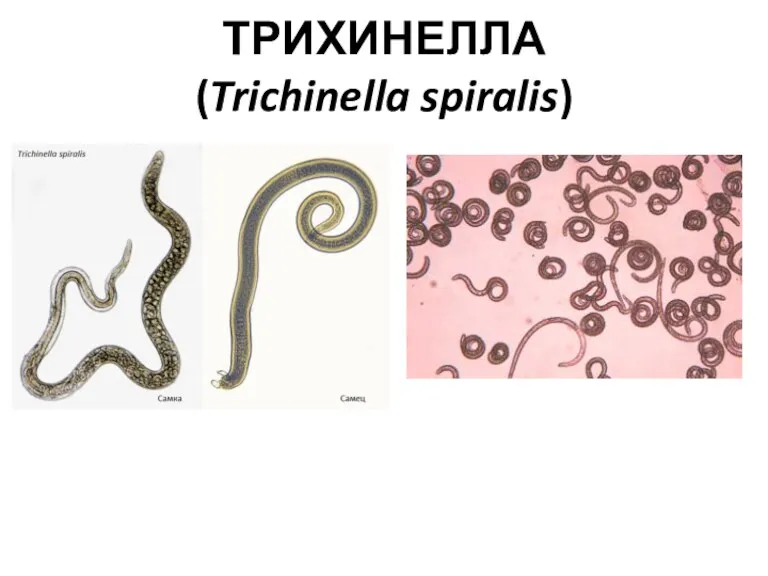 ТРИХИНЕЛЛА (Trichinella spiralis)