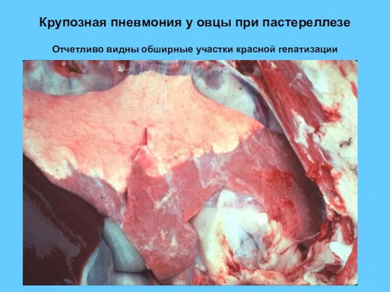 Крупозная пневмония у овцы при пастереллезе Отчетливо видны обширные участки красной гепатизации