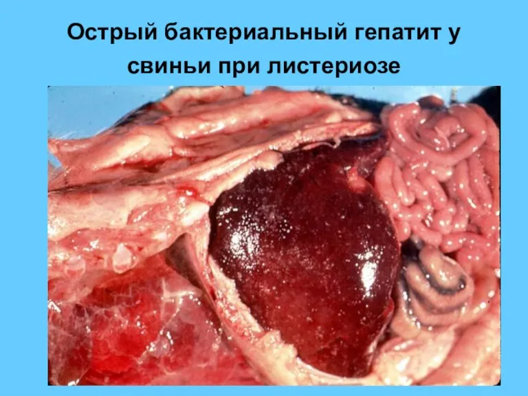 Острый бактериальный гепатит у свиньи при листериозе
