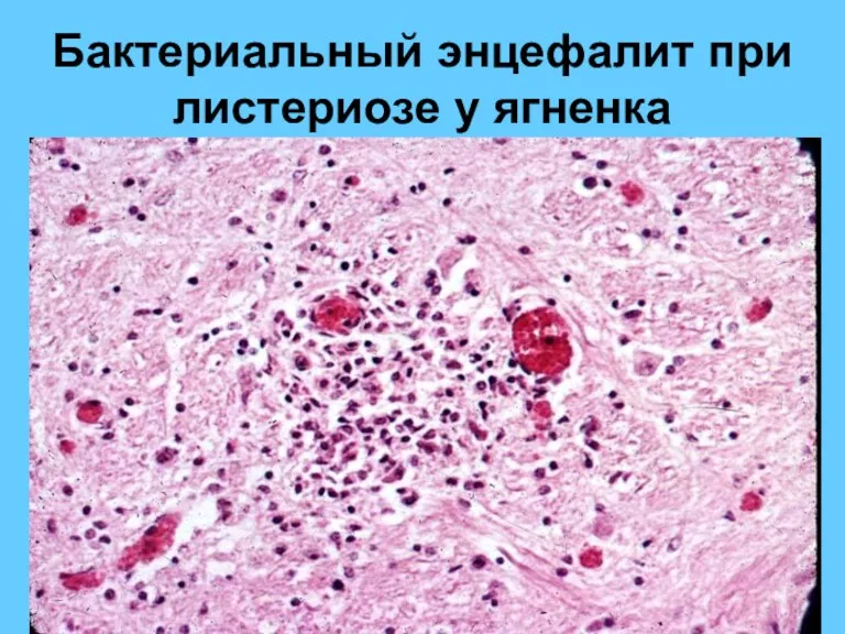 Бактериальный энцефалит при листериозе у ягненка