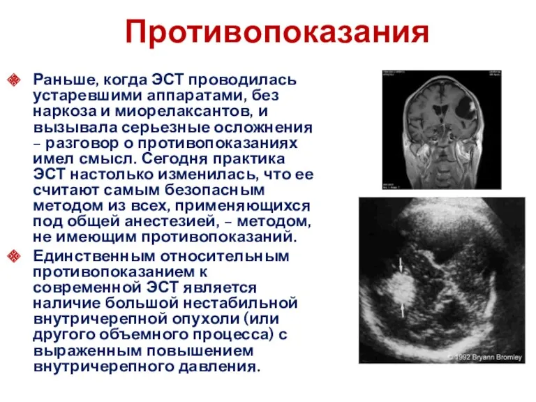 Противопоказания Раньше, когда ЭСТ проводилась устаревшими аппаратами, без наркоза и