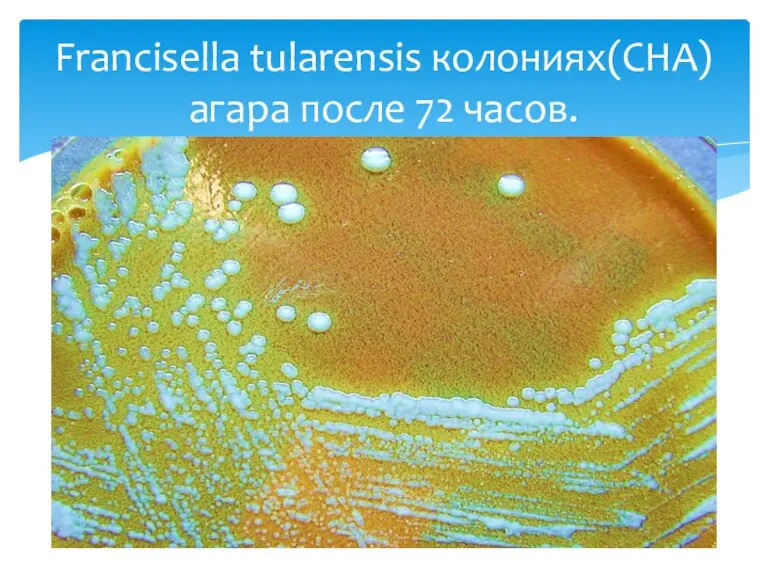 Francisella tularensis колониях(СHA) агара после 72 часов.