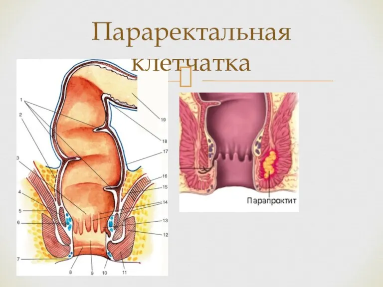 Параректальная клетчатка