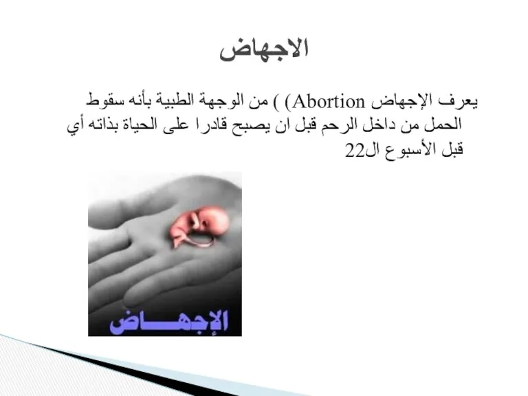 يعرف الإجهاض Abortion) ) من الوجهة الطبية بأنه سقوط الحمل