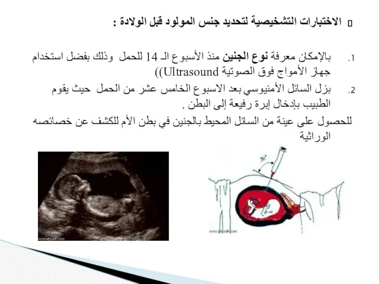 الاختبارات التشخیصیة لتحدید جنس المولود قبل الولادة : بالإمكان معرفة