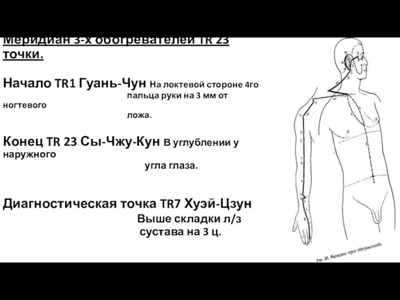 Меридиан 3-х обогревателей TR 23 точки. Начало TR1 Гуань-Чун На