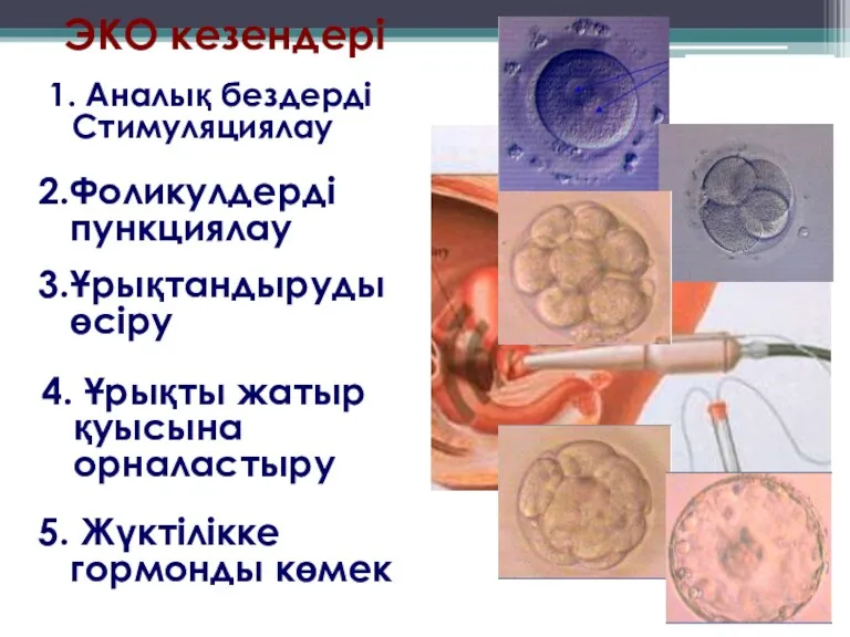 ЭКО кезендері 1. Аналық бездерді Стимуляциялау 2.Фоликулдерді пункциялау 4. Ұрықты