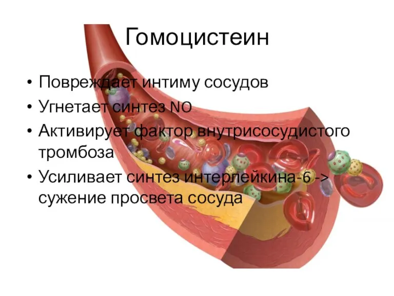 Гомоцистеин Повреждает интиму сосудов Угнетает синтез NO Активирует фактор внутрисосудистого