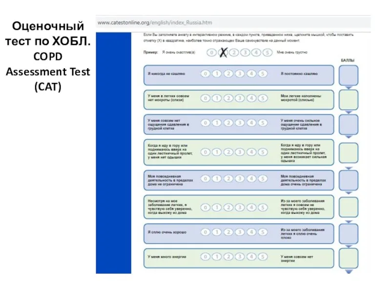 Оценочный тест по ХОБЛ. COPD Assessment Test (CAT)