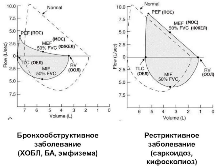 Бронхообструктивное заболевание (ХОБЛ, БА, эмфизема) Рестриктивное заболевание (саркоидоз, кифосколиоз)