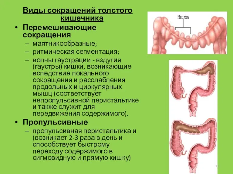 Виды сокращений толстого кишечника Перемешивающие сокращения маятникообразные; ритмическая сегментация; волны