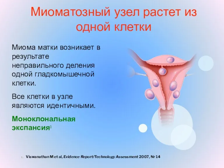 Миоматозный узел растет из одной клетки Viswanathan M et al,