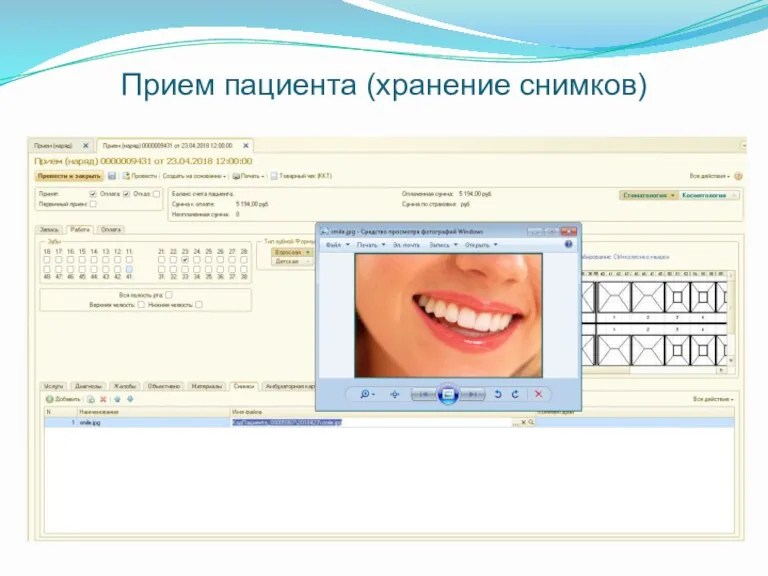 Прием пациента (хранение снимков)