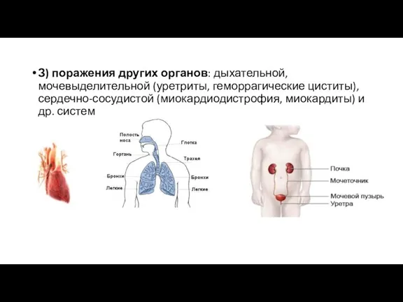 З) поражения других органов: дыхательной, мочевыделительной (уретриты, геморрагические циститы), сердечно-сосудистой (миокардиодистрофия, миокардиты) и др. систем