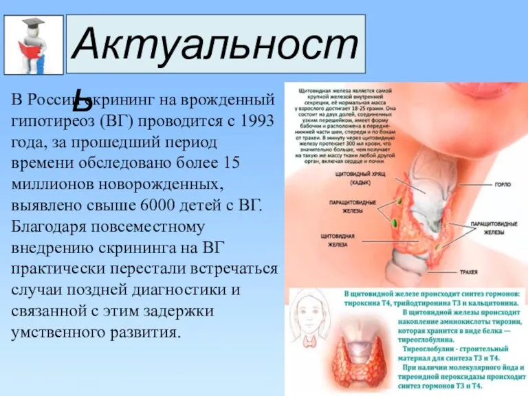 Актуальность В России скрининг на врожденный гипотиреоз (ВГ) проводится с