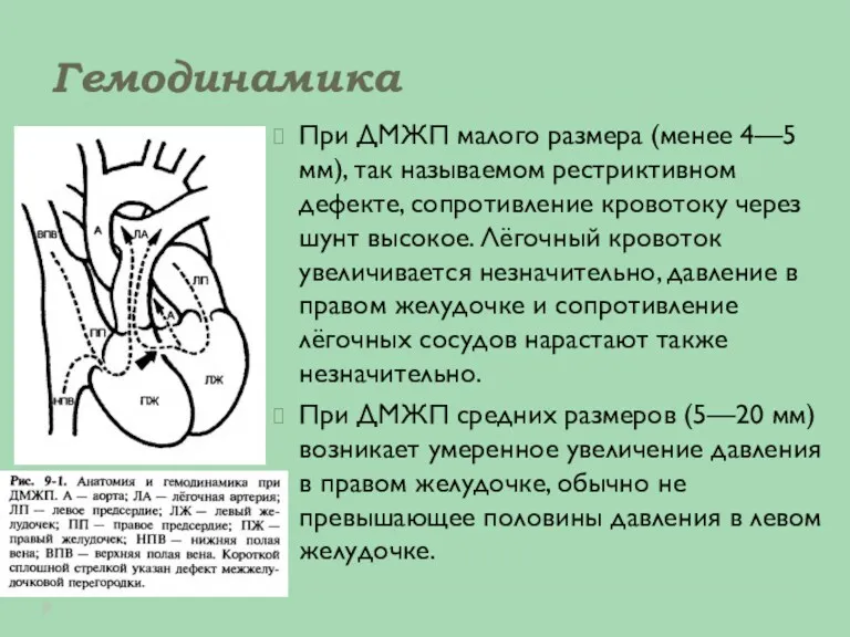 Гемодинамика При ДМЖП малого размера (менее 4—5 мм), так называемом