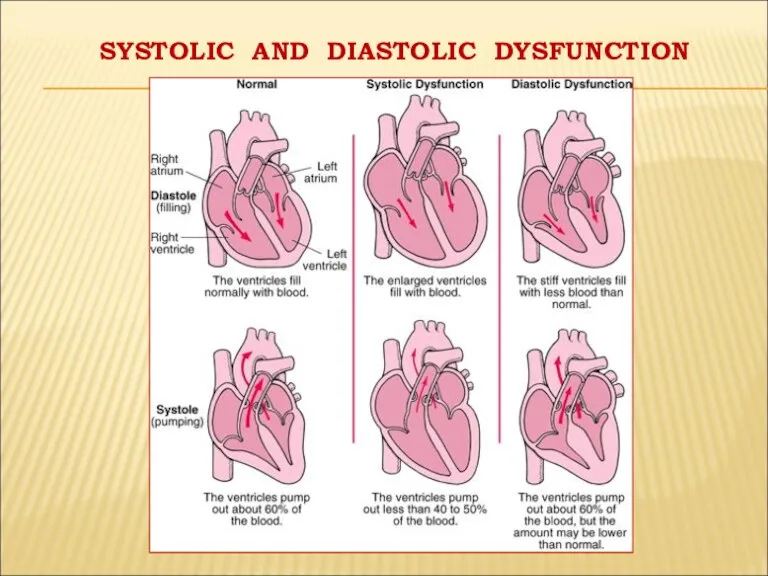 SYSTOLIC AND DIASTOLIC DYSFUNCTION