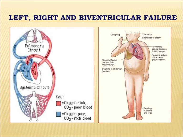 LEFT, RIGHT AND BIVENTRICULAR FAILURE