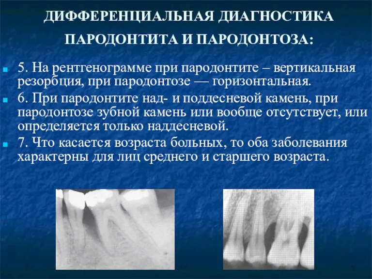 ДИФФЕРЕНЦИАЛЬНАЯ ДИАГНОСТИКА ПАРОДОНТИТА И ПАРОДОНТОЗА: 5. На рентгенограмме при пародонтите