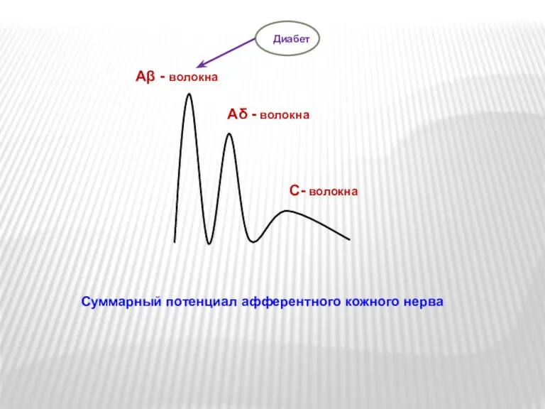 Аβ - волокна Аδ - волокна С- волокна Суммарный потенциал афферентного кожного нерва Диабет