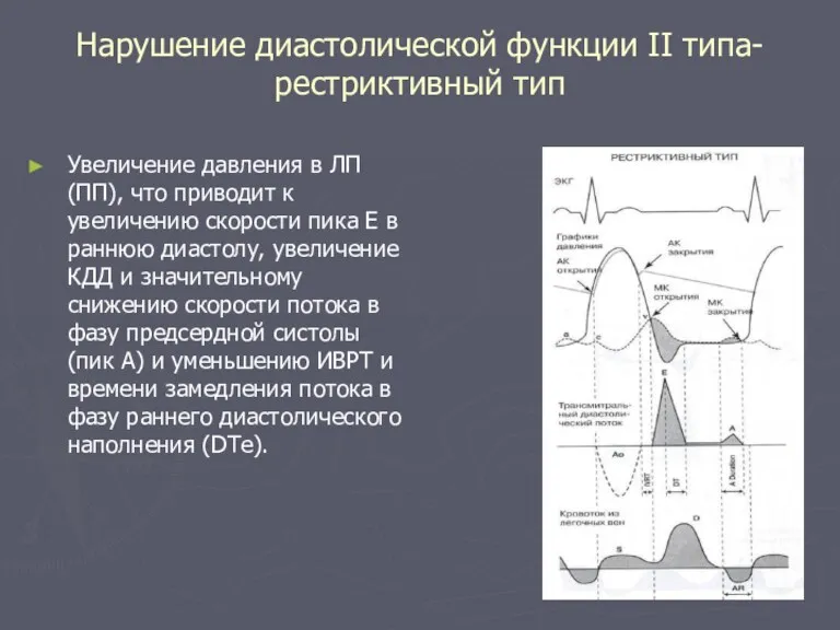 Нарушение диастолической функции II типа- pестриктивный тип Увеличение давления в