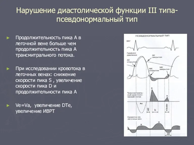 Нарушение диастолической функции III типа- псевдонормальный тип Продолжительность пика А