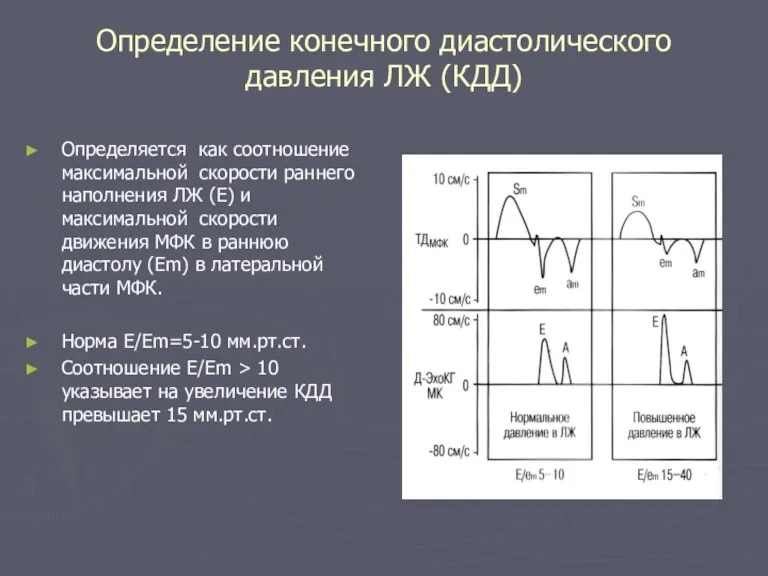 Определение конечного диастолического давления ЛЖ (КДД) Определяется как соотношение максимальной