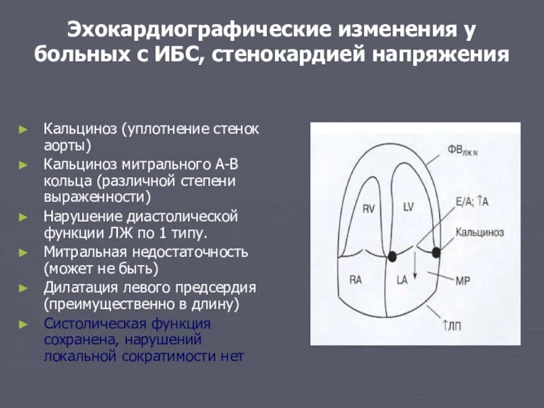 Эхокардиографические изменения у больных с ИБС, стенокардией напряжения Кальциноз (уплотнение