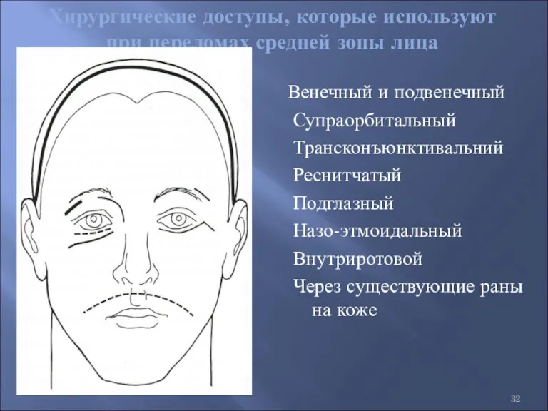 Хирургические доступы, которые используют при переломах средней зоны лица Венечный