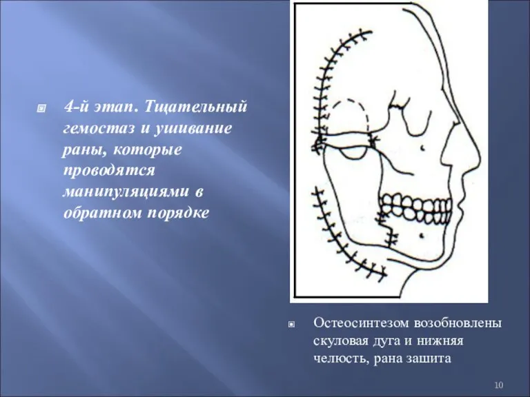 4-й этап. Тщательный гемостаз и ушивание раны, которые проводятся манипуляциями