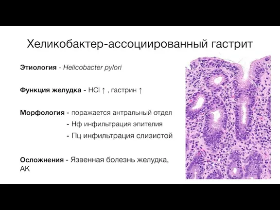 Этиология - Helicobacter pylori Функция желудка - HCl ↑ ,