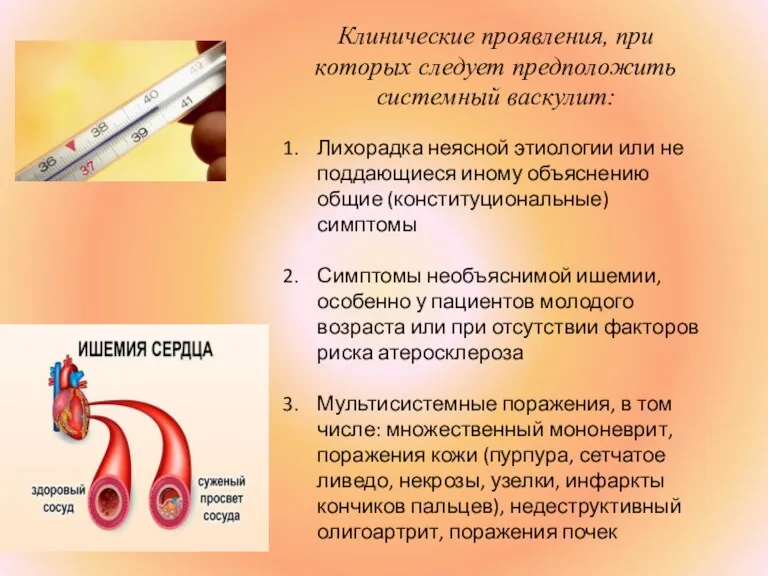 Клинические проявления, при которых следует предположить системный васкулит: Лихорадка неясной